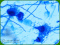 Aspergillus fumigatus
